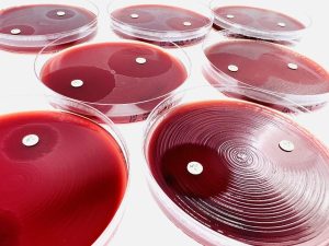 FAA-HB? ?Fastidious Anaerobe Agar with Horse Blood