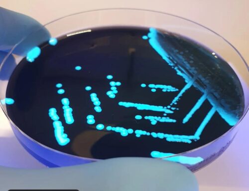 Legionella BCYE Agar