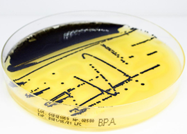 Baird Parker Agar