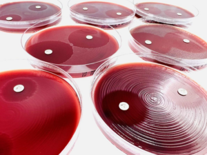 FAA-HB  Fastidious Anaerobe Agar w/ Horse Blood